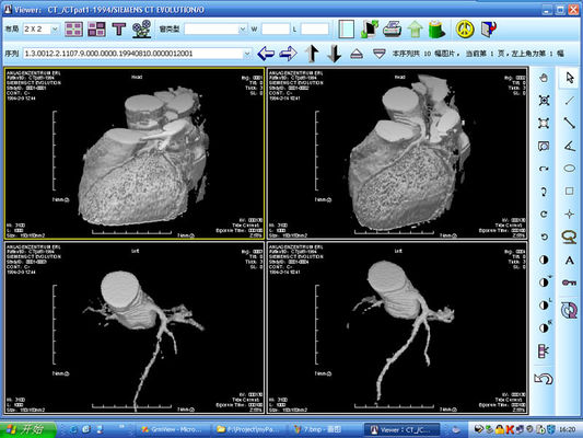 अच्छा दाम KND-DRYTEC 4000 के लिए लेजर प्रिंटर एक्स रे डायग्नोस्टिक इमेजिंग सिल्वर हैलाइड ऑनलाइन