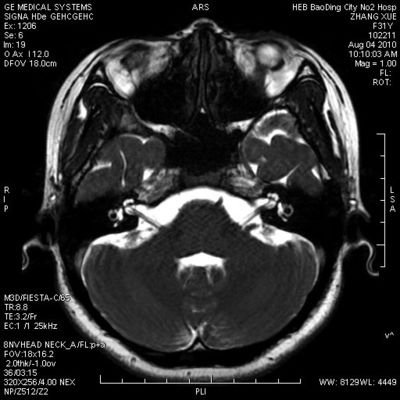 अच्छा दाम थर्मल प्रिंटर के लिए वॉटरप्रूफ होलोग्राफिक एक्स रे ड्राई फिल्म KND-A, AGFA 5300/5500/5302 ऑनलाइन