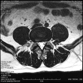 अच्छा दाम KNFA-A लो फॉग मेडिकल ड्राई इमेजिंग फिल्म एक्स रे परीक्षा के लिए AGFA 5300 11in × 14in पर ऑनलाइन