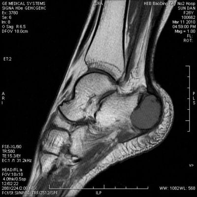 अच्छा दाम KND-A उच्च मैक्स घनत्व चिकित्सा सूखी इमेजिंग फिल्म थर्मल प्रिंटर के साथ संगत ऑनलाइन
