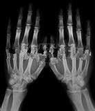 अच्छा दाम कोनिडा लेजर प्रिंटर के लिए 13in * 17in लो फॉग मेडिकल एक्सरे पेपर फिल्म ऑनलाइन