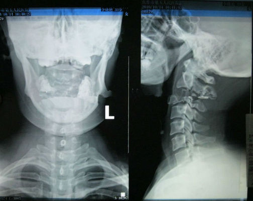 अच्छा दाम लेजर प्रिंटर के लिए हाई शार्पनेस वेयरेबल कोनिडा मेडिकल इमेजिंग एक्सरे पेपर ऑनलाइन