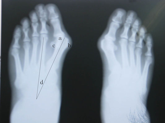 अच्छा दाम पनरोक एक्स रे नैदानिक ​​इमेजिंग ऑनलाइन