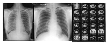 अच्छा दाम डबल लेयर के साथ 14 x 17 इंच थर्मल प्रिंटर फिल्म ब्राइट टोन ऑनलाइन