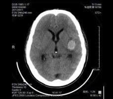अच्छा दाम कोनिडा मेडिकल एक्स रे ड्राई फिल्म थर्मल के लिए AGFA 5300 / फ़ूजी 3000 ऑनलाइन