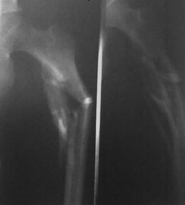 अच्छा दाम फ़ूजी मेडिकल थर्मल प्रिंटर फिल्म ऑनलाइन