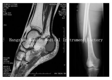 अच्छा दाम फ़ूजी / AGFA थर्मल प्रिंटर्स के साथ पर्यावरण संरक्षण मेडिकल ड्राई इमेजिंग फ़िल्म ऑनलाइन