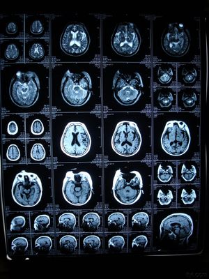 अच्छा दाम AGFA / फ़ूजी प्रिंटर के लिए कस्टम मेड कोनिडा मेडिकल डिजिटल एक्स-रे ड्राई इमेजिंग फिल्म ऑनलाइन