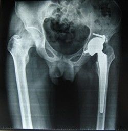 अच्छा दाम कम फोग ब्लूश पॉलिएस्टर बेस कोनिडा मेडिकल ड्राई इमेजिंग फिल्म 28 सेमी * 35 सेमी थर्मल प्रिंटर के लिए ऑनलाइन