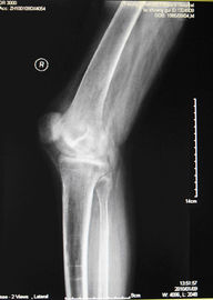 अच्छा दाम KND-A लो फॉग मेडिकल ड्राई इमेजिंग फिल्म एक्स रे परीक्षा के लिए AGFA 5300, 5302, 5500 पर ऑनलाइन