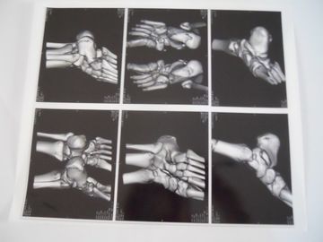 अच्छा दाम AGFA 5300, 5302, 5500 पर एक्स रे परीक्षा के लिए मेडिकल ड्राई इमेजिंग फिल्म ऑनलाइन