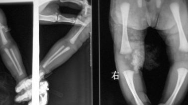Good price 20 x 25 सेमी लेजर एक्स रे मेडिकल इमेजिंग, DT1B / DT2B Agfa X Ray फिल्म ऑनलाइन