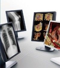 Good price स्पष्ट चित्र मेडिकल ग्रेड डिस्प्ले, 5MP ग्रे स्केल मेडिकल डिस्प्ले ऑनलाइन