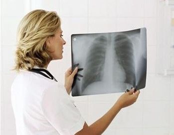 Good price 20 सेमी एक्स 25 सेमी एक्स रे डायग्नोस्टिक इमेजिंग ऑनलाइन