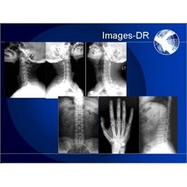 Good price फ्लेक्सिबल UC आर्म के साथ Mammogrpahy X-RAY डिजिटल रेडियोग्राफी मशीन ऑनलाइन