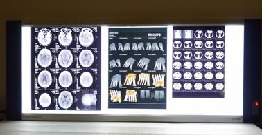 फ़ूजी / अगफा एक्स रे फिल्म, 8in x 10in मेडिकल ड्राई टर्मल प्रिंटर फिल्म