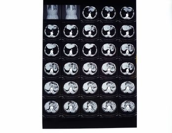 Good price मेडिकल एक्स रे फिल्म्स, सीटी / डीआर / एमआरआई के लिए थर्मल प्रिंटर के साथ संगत सूखी इमेजिंग फिल्म ऑनलाइन